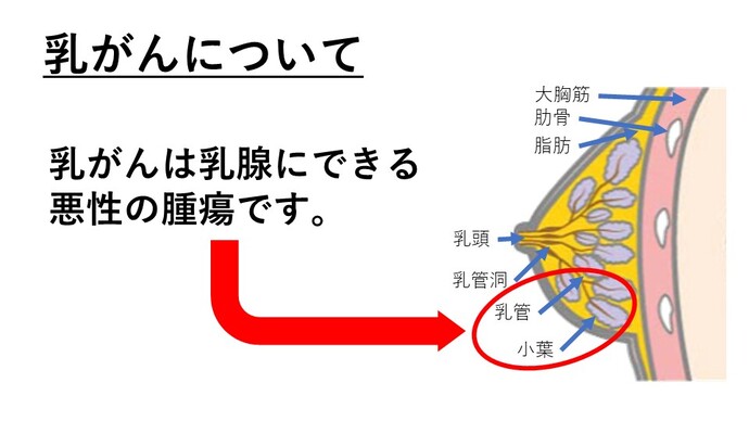 乳がん