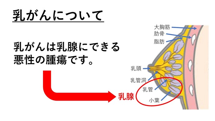乳がん